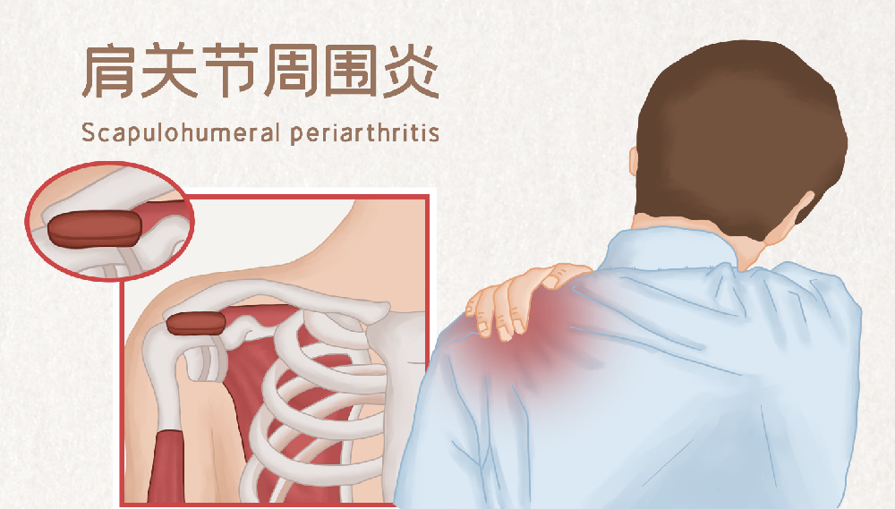 邵陽創(chuàng)傷骨科,邵陽風濕病區(qū),邵陽骨質(zhì)增生,邵陽關節(jié)病區(qū),邵陽頸椎病區(qū)