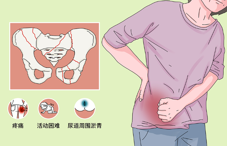 邵陽創(chuàng)傷骨科,邵陽風(fēng)濕病區(qū),邵陽骨質(zhì)增生,邵陽關(guān)節(jié)病區(qū),邵陽頸椎病區(qū)